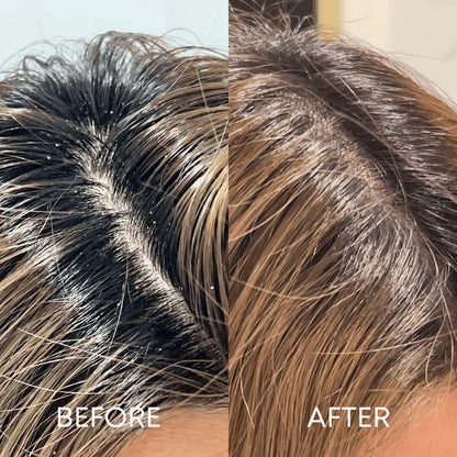 Scalp Scrubber